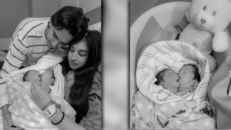 Conjoined twins pass away at Banner UMC