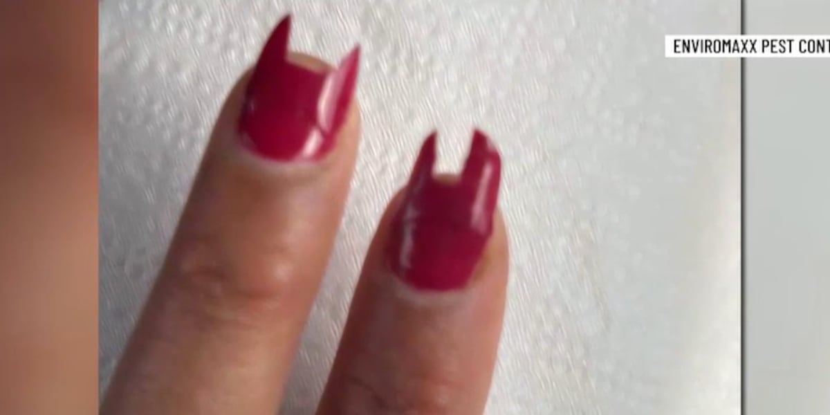 Rat chewed off part of woman’s fingernails in Las Vegas Valley, pest control GM says