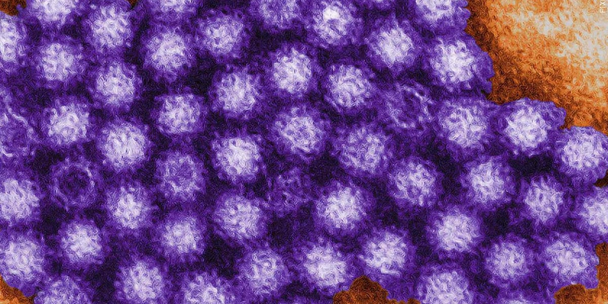 Casino Del Sol confirms norovirus outbreak caused cancellation of Wild Wild West Steampunk Convention - KOLD